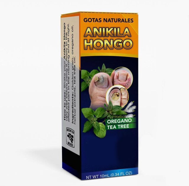 Anakila Hongo
