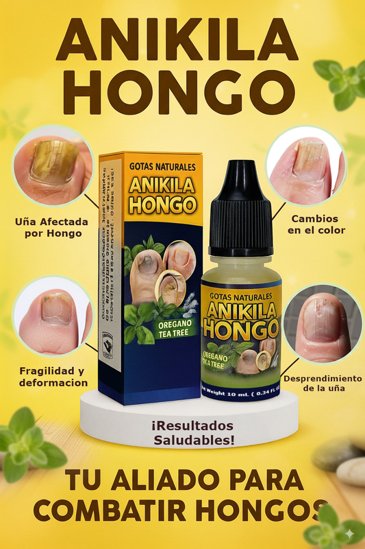 Anakila Hongo